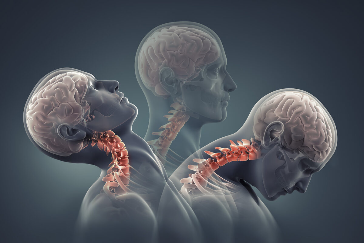 PHYSIOTHERAPY TREATMENT FOR NECK PAIN