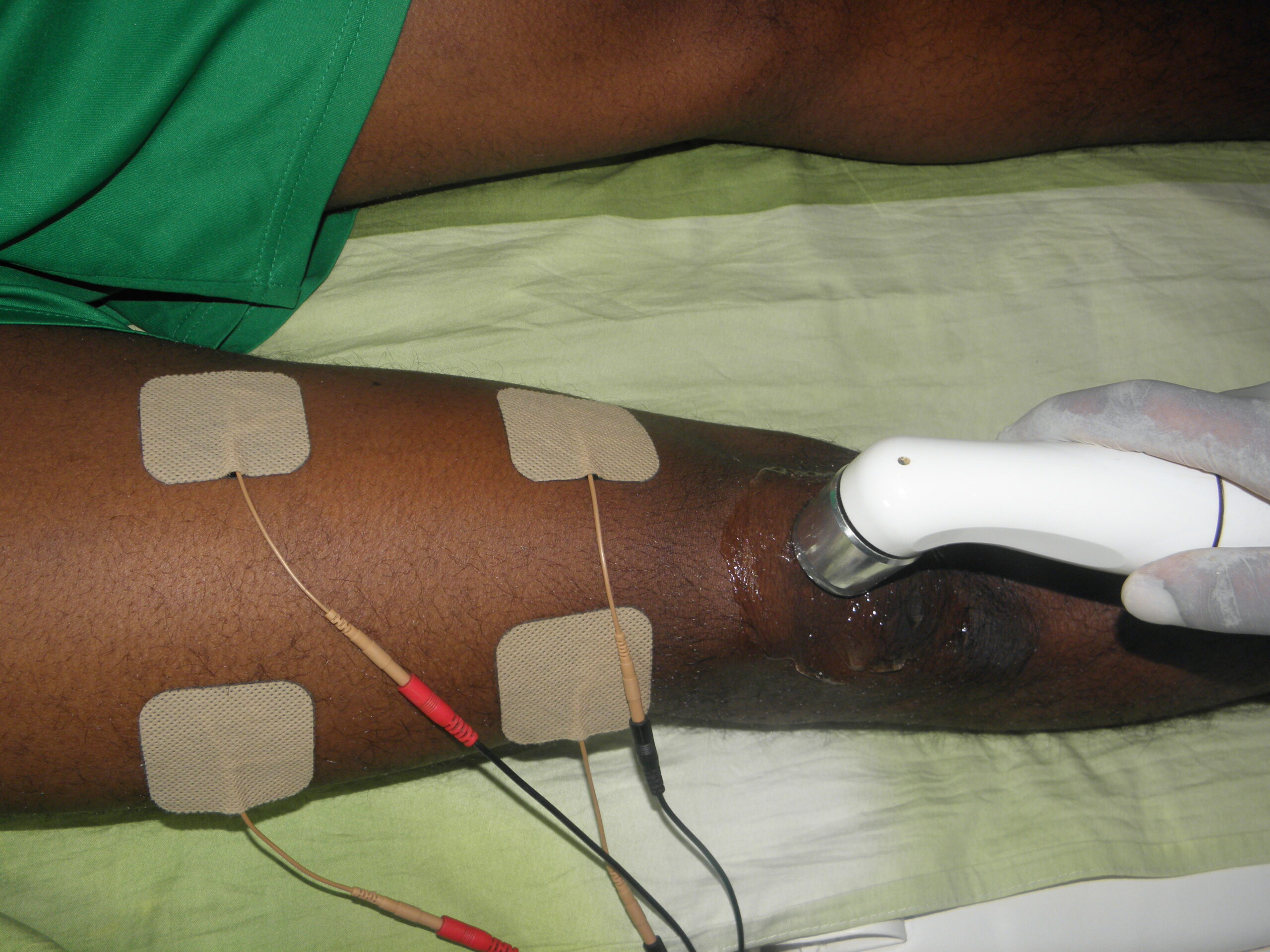 Where can I get a Physiotherapist in Abuja?
