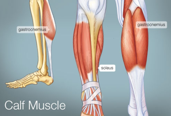 Not all calf strains are the same…. — Maximise Physiotherapy Clinic