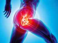 knee replacement Management