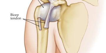shoulder dislocation treatment